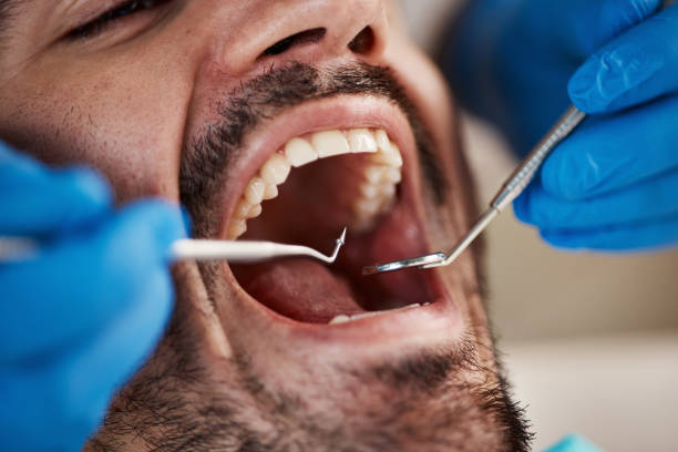 Best Broken or Cracked Tooth Emergency Dentist in Painted Post, NY